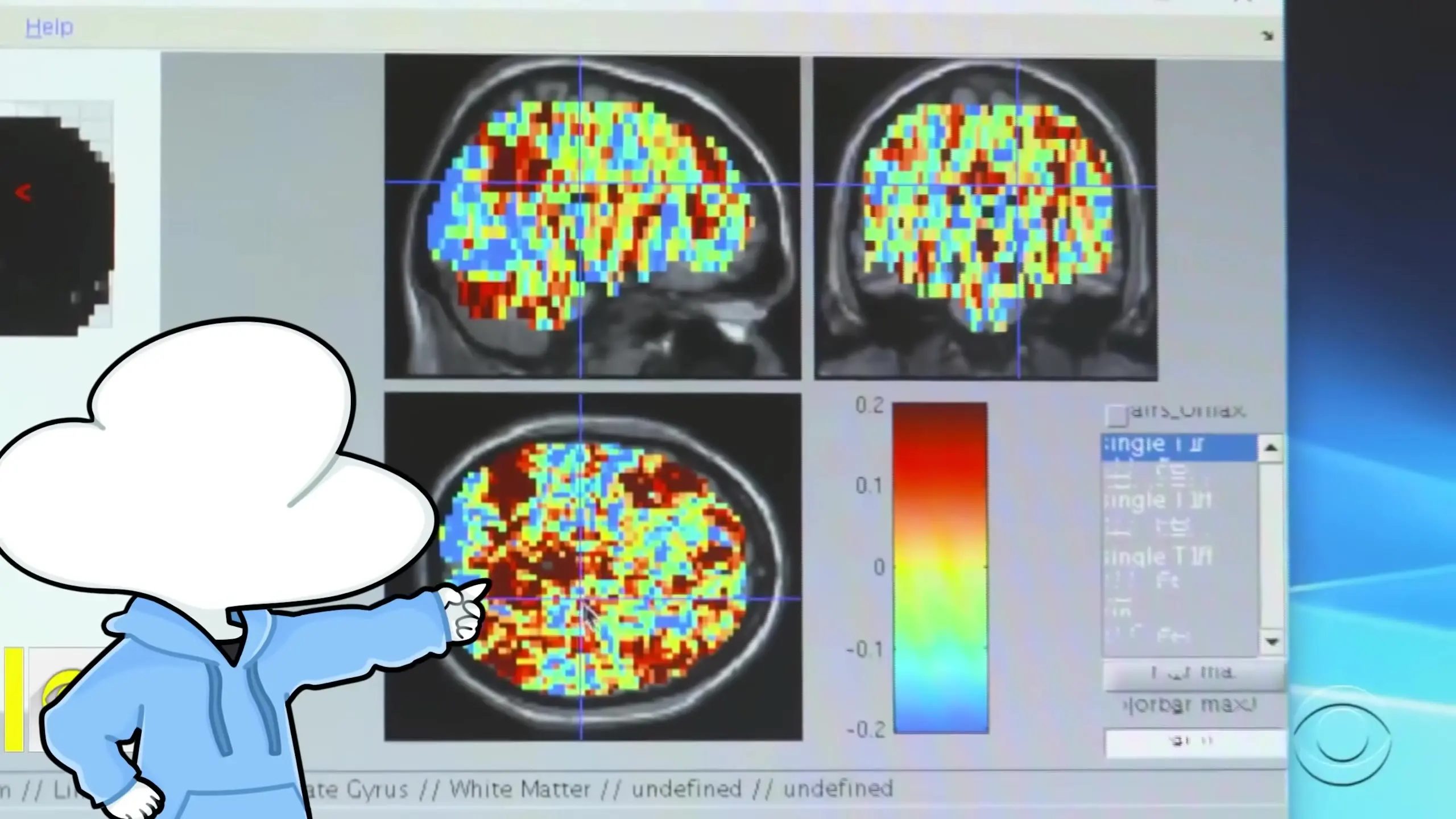 Brain research suggests that when humans reason, the language centers aren't heavily activated, indicating reasoning may not be language-dependent